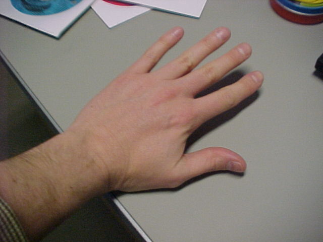 My Left Hand. Less Hairy Than Before.